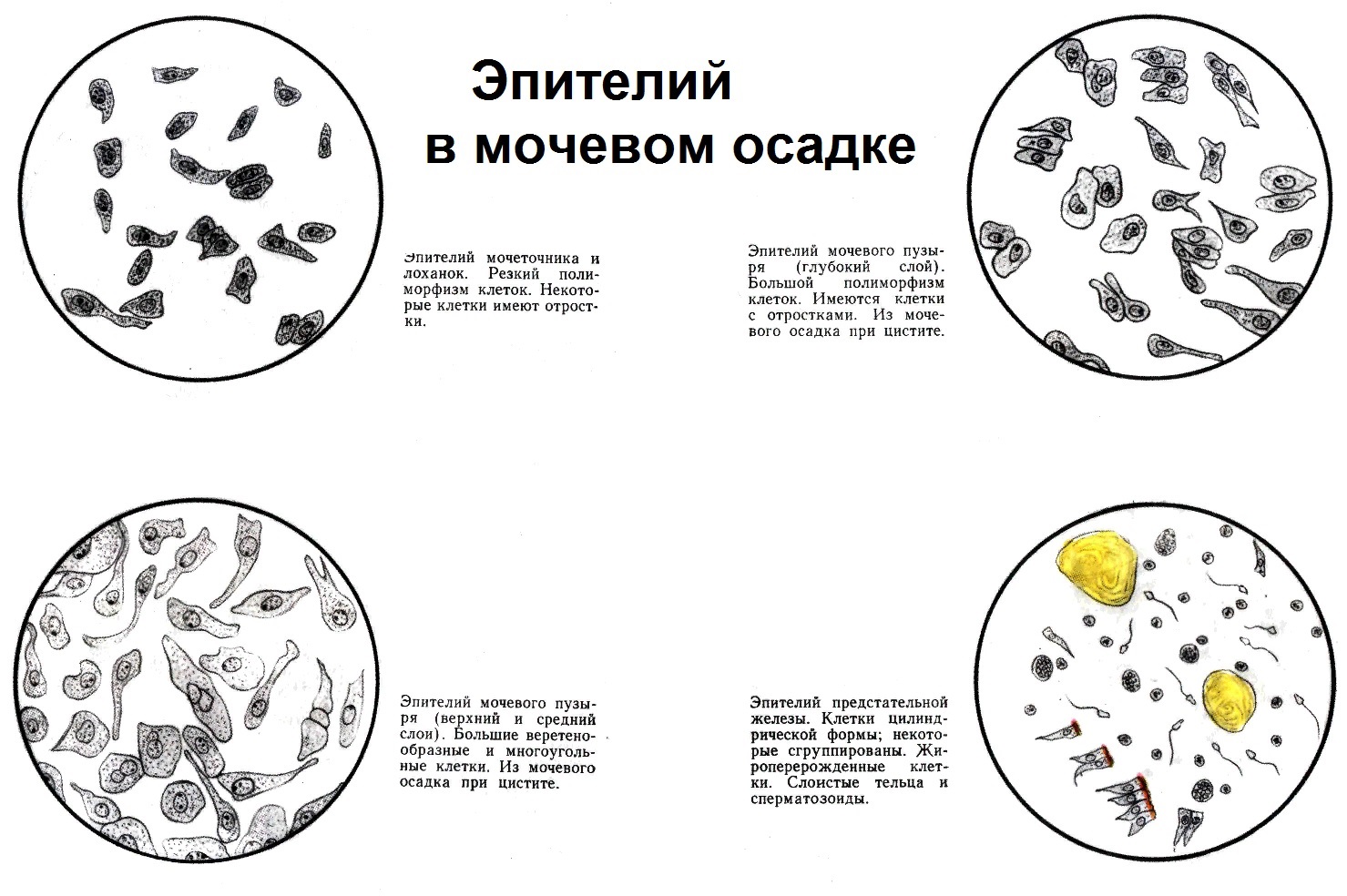 Анализ показателей мочи